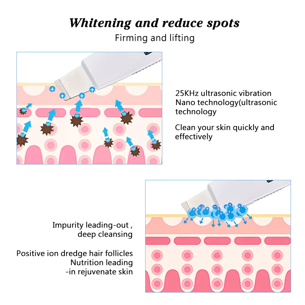 SonicGlow Skin Cleanser